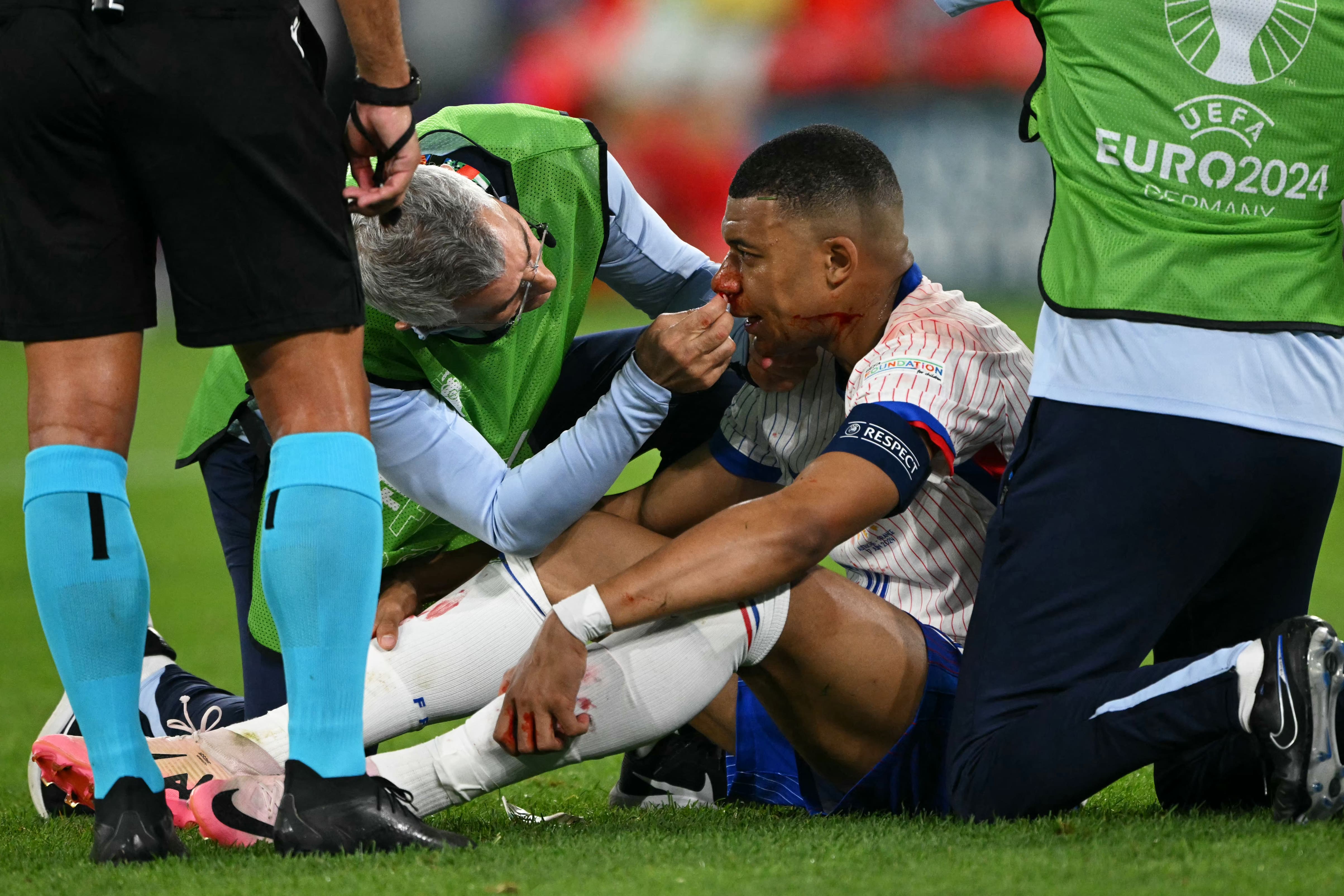 Koszmarne zderzenie i złamany nos Mbappe. Francja wygrywa z Austrią 1:0